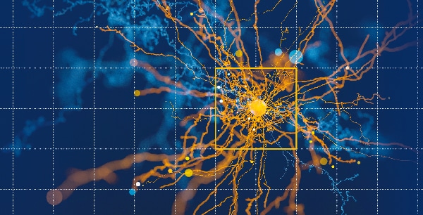 Automatisierte Qualitätssicherung mit MVTec HALCONs Anomaly Detection – am Beispiel Lebensmittelindustrie